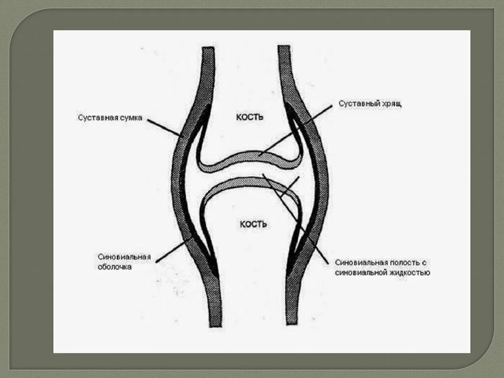 Какие структуры сустава. Диартрозы строение сустава. Суставная полость схема. Суставная поверхность строение сустава анатомия. Диартрозы структура.