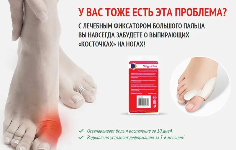 Фиксатор "valgus Pro" (вальгус про). Фиксатор вальгус про для большого пальца ноги. Средство от косточек на ногах. Средство от шишек на ногах.