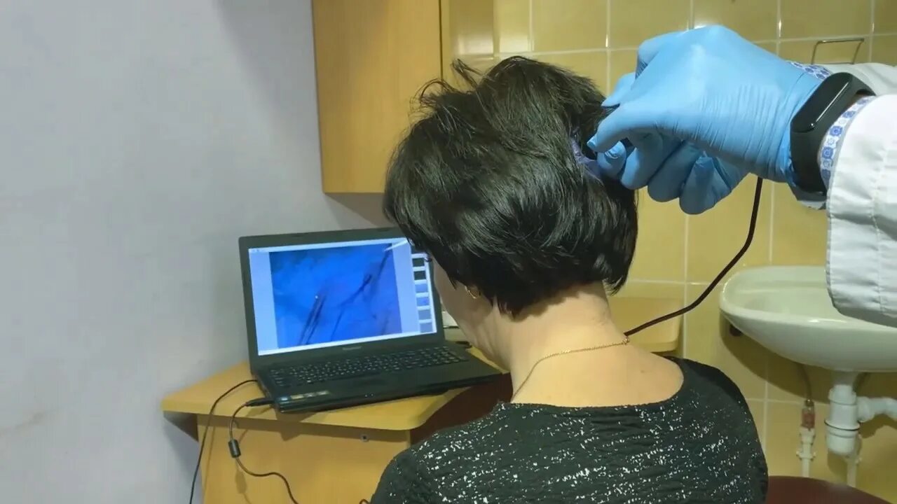 Врач трихолог. Компьютерная диагностика волос. Трихоскопия (компьютерная диагностика волос). Консультация трихолога. Какой врач по волосам