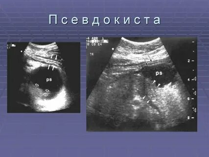 Узи малых желез
