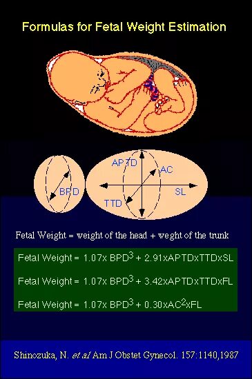 Расчет предполагаемой массы плода по УЗИ. БПР плода. Бипариетальный размер. Фетометрия плода БПР. Окружность головы плода