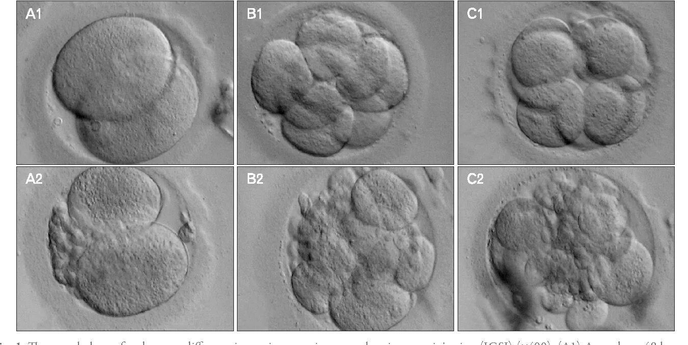 Сколько эмбрионов форум. Эко стадии развития эмбриона. Эко ИКСИ стадии развития эмбриона. Стадии развития эмбриона при эко.