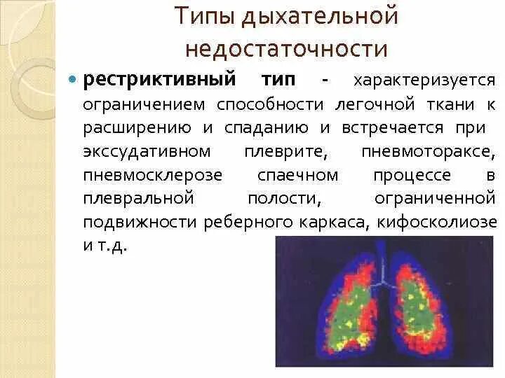 Обструктивный и рестриктивный типы дыхательной недостаточности. Рестриктивный Тип дыхательной недостаточности механизм. Гиповентиляция легких рестриктивного типа это. Типы нарушения легочной вентиляции.