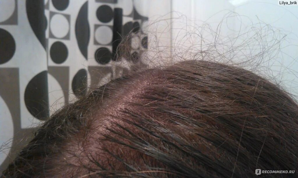 Строение стержня волоса медула. Кончик лука под микроскопом. Полость внутри волоса. Строение волоса типы волос. Кортекс медулла.