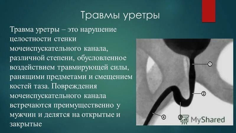 цвет мочеиспускательного канала