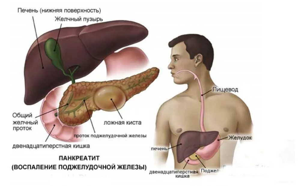 Болезни печени и поджелудочной. Поджелудочная железа фото. Фото поджелудочной железы у человека. Печень и поджелудочная железа.