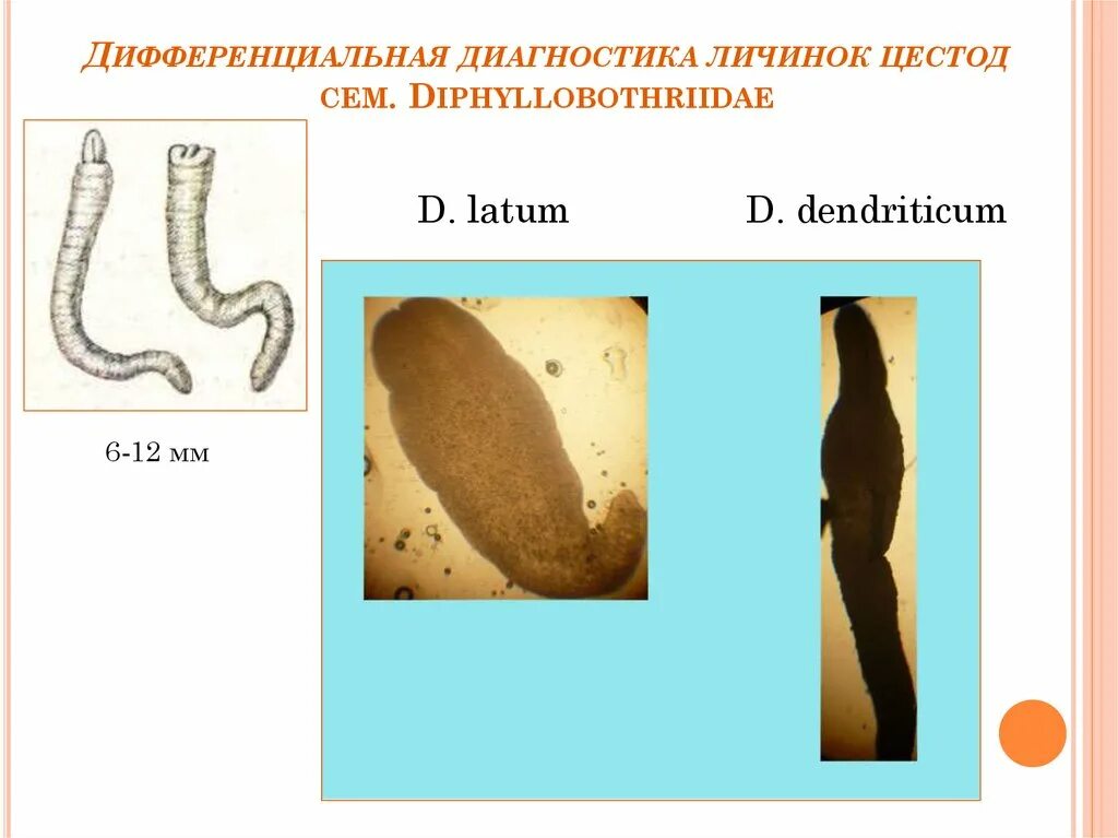 Личинки лентеца. Личинка широкого лентеца. Классификация цестод.