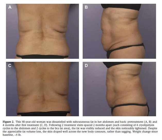 Access body