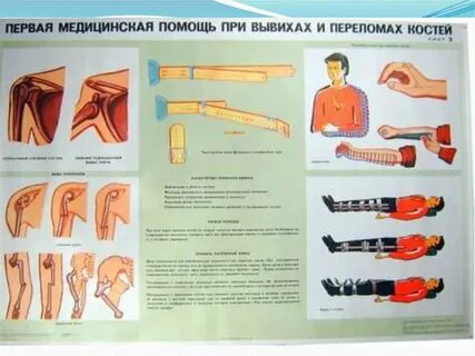 Раны перелом вывихи