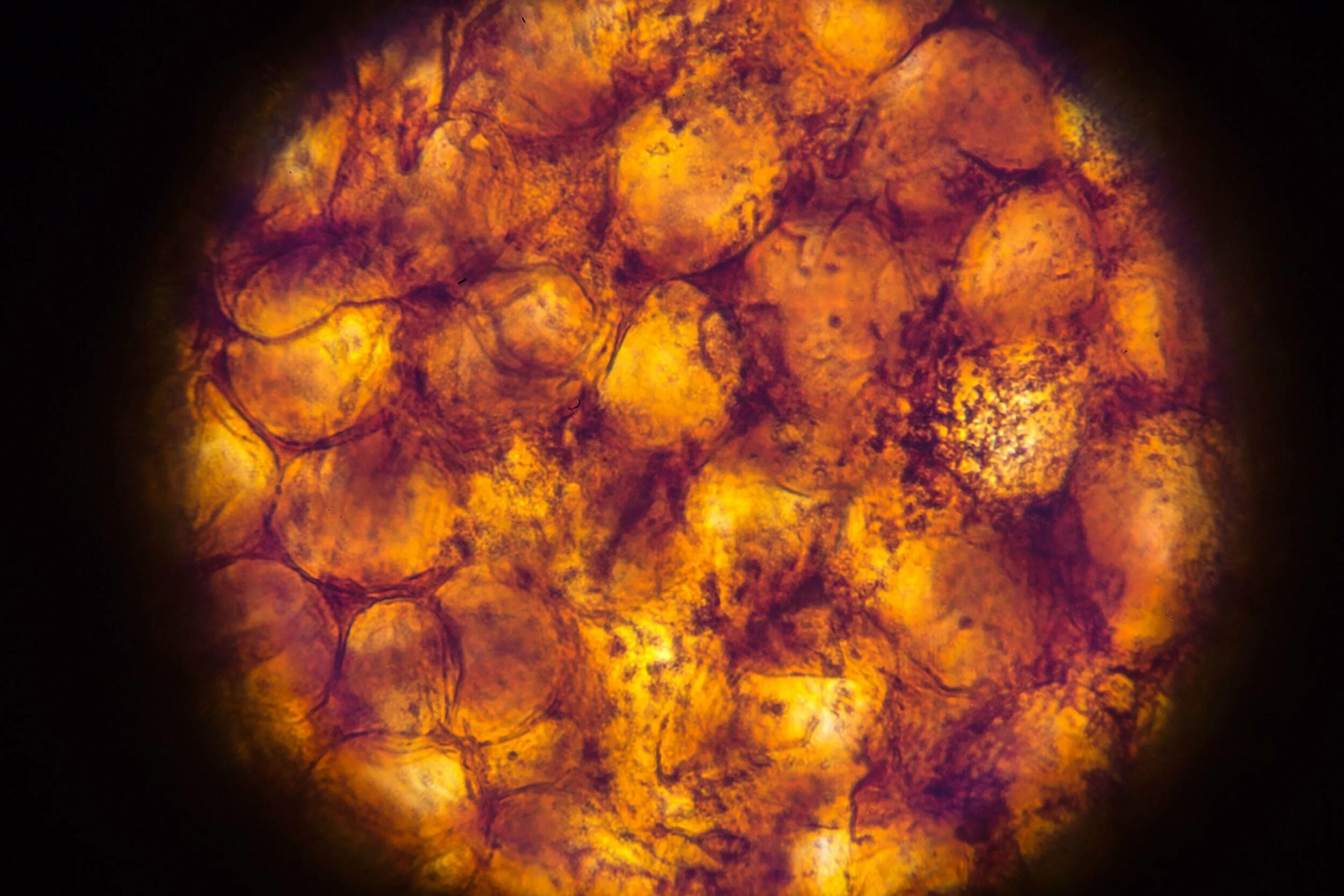 Бурый адипоцит. Жировая ткань бурая в микроскопе. Бурая жировая ткань ПЭТ кт. Жировые клетки под микроскопом.