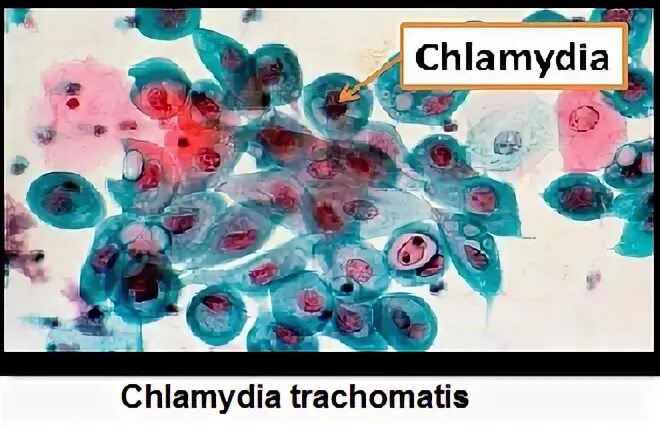 Anti chlamydia trachomatis