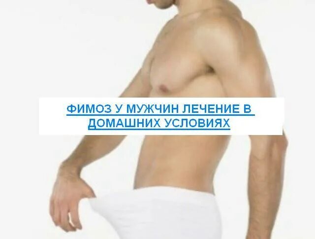 Лечу фимозу