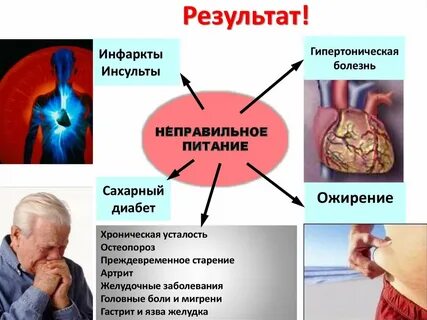 Желудочно кишечный инфаркт