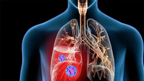 i?id=467e7f3f25f48e36fa44523d2916632f0aa9bb84-7662004-images-thumbs&n=13