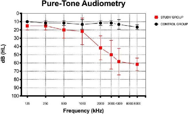 Pure-Tone Audiometry. Герцы 369 Pure Tone. Pure tone