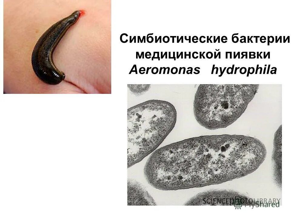 к какому типу относится медицинская пиявка