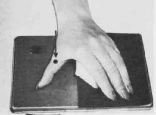 Пальцев 1 том. Рентген укладка 1 пальца кисти. Рентген кисти косая проекция. Снимок кисти в косой проекции.