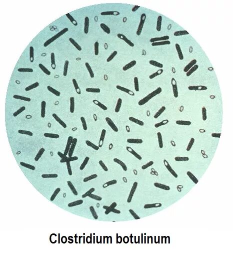 Clostridium spp. Возбудитель - Clostridium botulinum. Клостридии ботулизма ( Clostridium botulinum ) ботулизм. Клостридия ботулизм возбудитель.