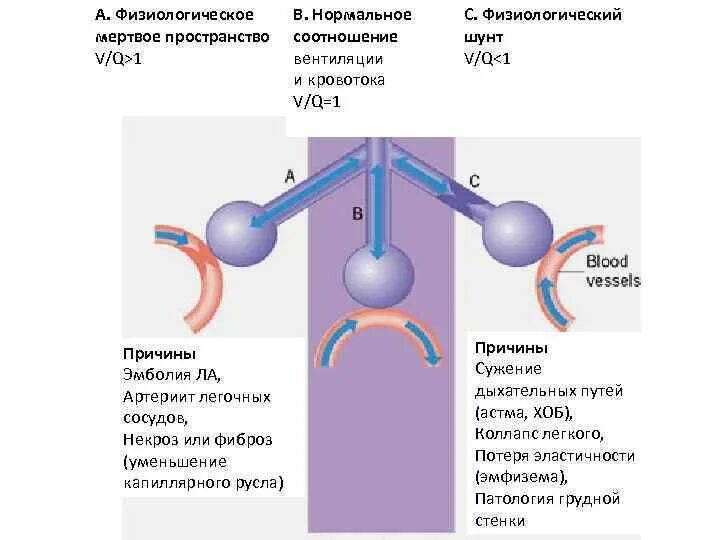 Анатомически и физиологически Мертвое пространство. Мертвое пространство легких Анатомическое физиологическое. Мертвое пространство дыхательных путей. Физиологическое мертвое пространство