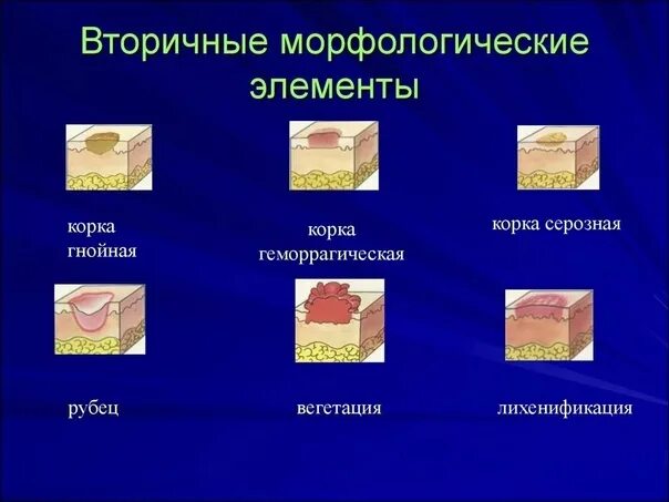 Пятно первичный элемент: найдено 78 картинок