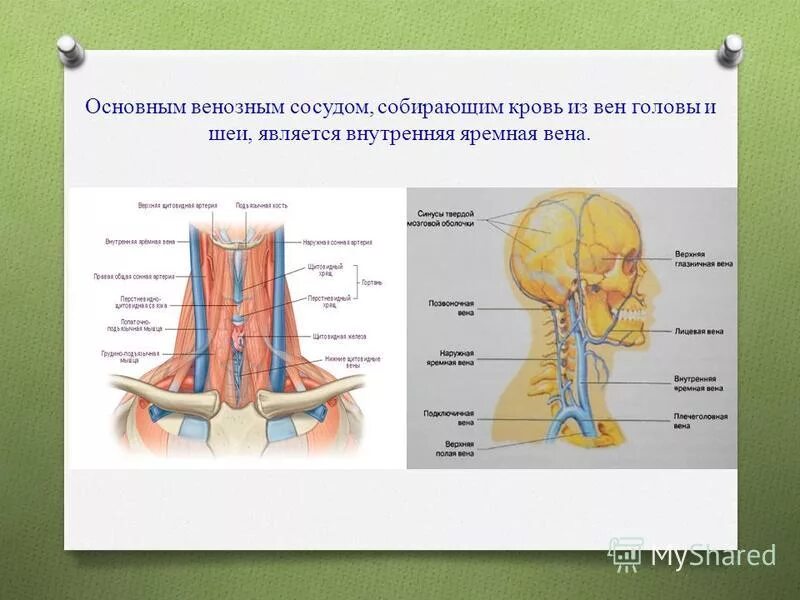 Яремная артерия где находится. Сонная артерия и яремная Вена. Наружная яремная Вена анатомия. Вены и артерии шеи анатомия. Внутренняя яремная Вена и Сонная артерия.