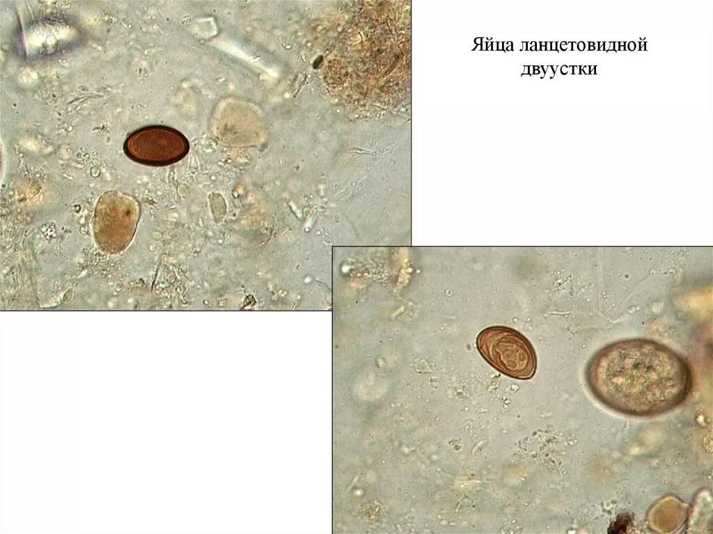 Яйца гельминтов Dicrocoelium lanceatum. Яйца трематод в микроскопе. Яйца гельминтов микроскопия атлас. Кошачья двуустка яйца микроскоп. Простейшие в кале лечение