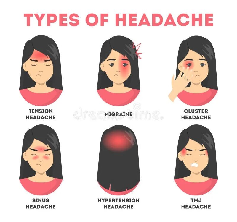 Головная боль в третьем триместре. Types of headache. виды головной боли. головная боль картинки. мигрень.