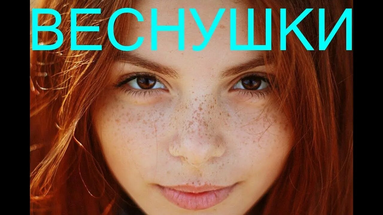 Веснушки я б отмыла. Веснушки. Подружки веснушки. Веснушки на английском.