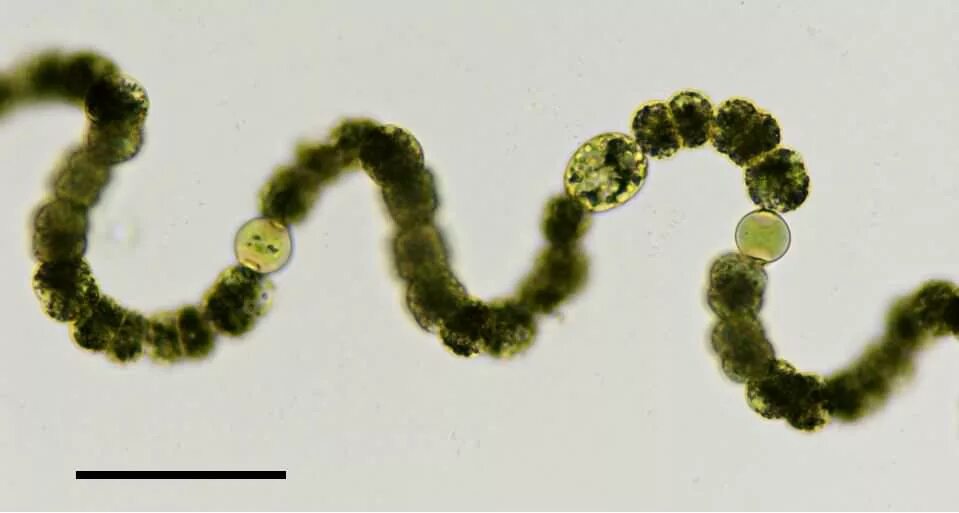 Anabaena constricta. сине зеленых водорослей рода anabaena. Anabaena sp. носток цианобактерия. сине зеленых водорослей рода anabaena.