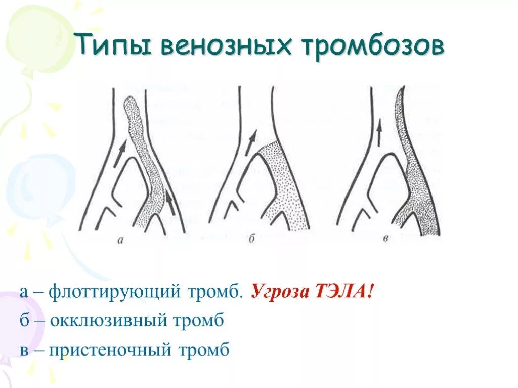 Глубочайший какая степень. Пристеночные тромбы строение. Окклюзирующий венозный тромбоз. Окклюзивный и пристеночный тромб.