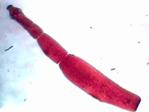 Паразиты эхинококкоз. Эхинококкоз пути заражения признаки. Alveococcus multilocularis препарат. Паразиты эхинококкоз. Круглые черви эхинококк.