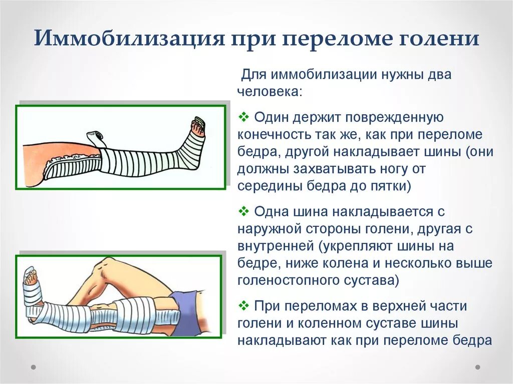 Закрытый перелом алгоритм. Транспортная иммобилизация при переломе голеностопного сустава. Реабилитация перелома малой малой берцовой. Алгоритм оказания неотложной помощи при переломах костей голени. Иммобилизация голени шиной Крамера.