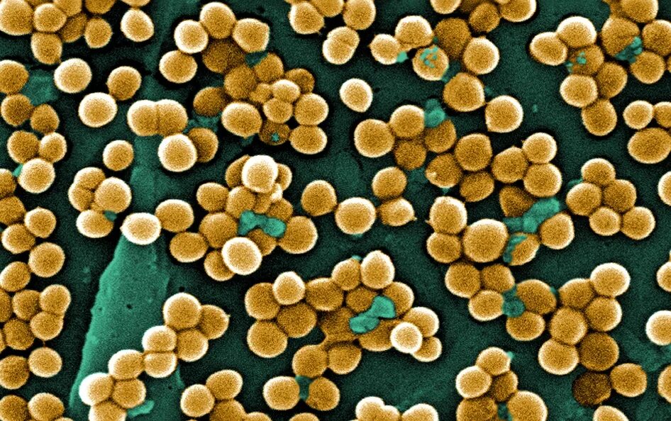 Staphylococcus aureus золотистый стафилококк. Стафилококкус ауреус. Бактерия золотистый стафилококк. МРСА золотистый стафилококк.