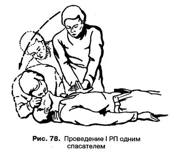 Сердечно легочная реанимация двумя спасателями