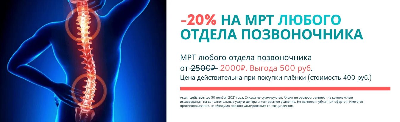 Скидка 20% на мрт. Мрт спектр диагностика Брянск. Мрт грудного отдела позвоночника. Мрт позвоночника Белгород. Мрт белгорода телефон