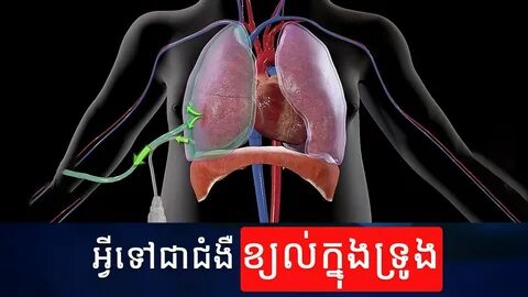 Пневмония операция