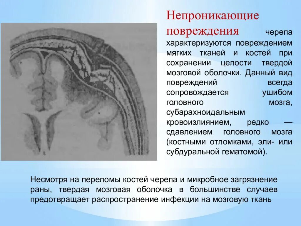 Травма головы мкб 10. Черепно-мозговая травма оболочки мозга. Непроникающая черепно-мозговая травма это. ЧМТ повреждения костей черепа. Открытая непроникающая ЧМТ.