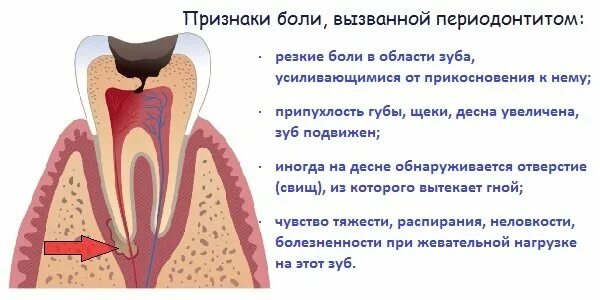 Пульсирующая боль в зубе причины. Пульсирующая боль в зубе причины