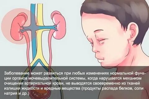 Почечное давление у женщин