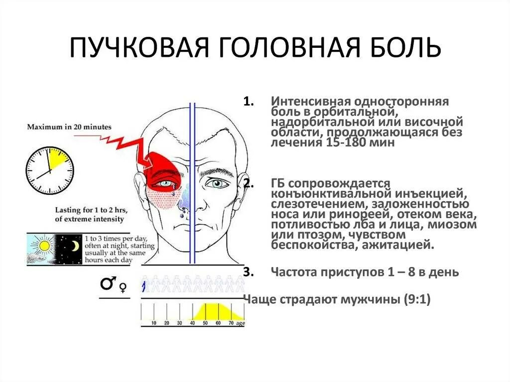 Отдает в глаз. Пучковая кластерная головная боль. Болит голова и глаза. Профилактика кластерной головной боли.