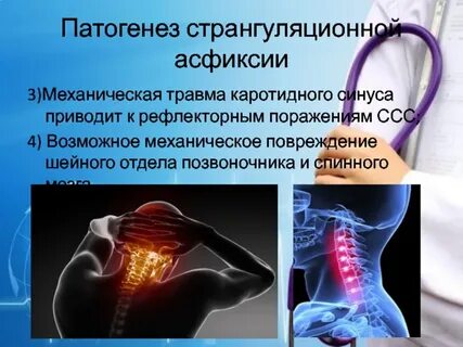 Мкб асфиксия