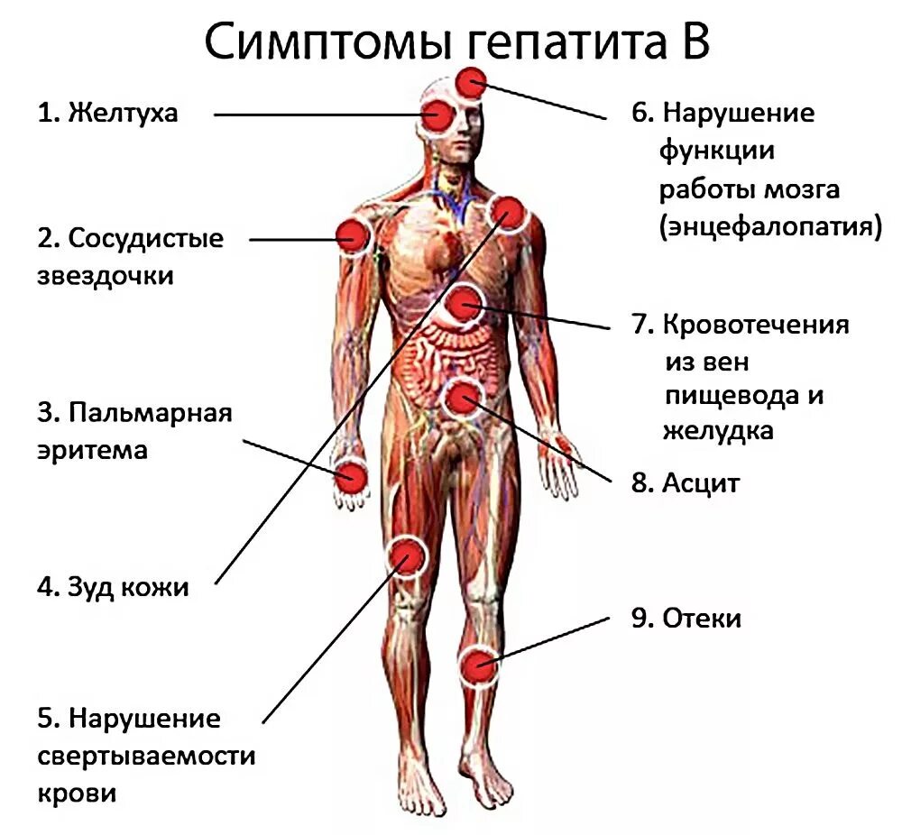 Клинические симптомы гепатита б. Вирусный гепатит симптомы. Симптомы гепатита в с симптомы. Гепатит б побочные эффекты