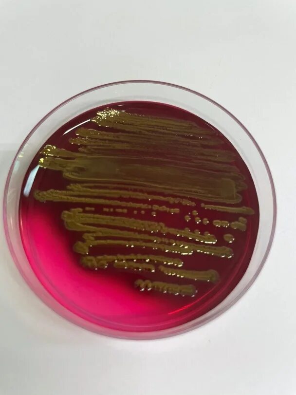 Coli sotwe. Кишечная палочка Escherichia coli. Кишечная палочка на Эндо. Колонии кишечной палочки. Бактерии группы кишечной палочки.