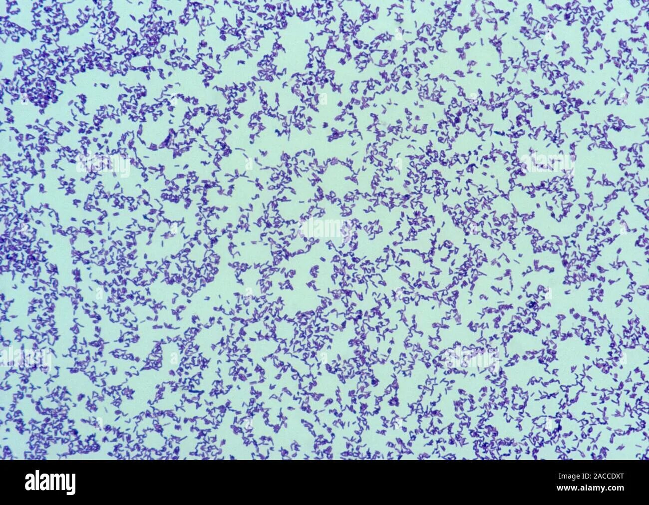 Mobiluncus spp corynebacterium в мазке. Коринобактерии гравис. коринебактерии дифтерии. corynebacterium amycolatum. коринебактериум стриатум.