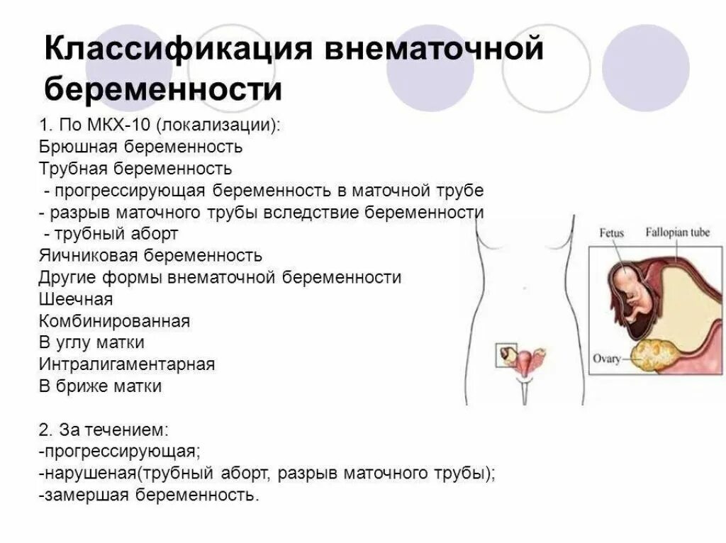 Как отличить внематочную беременность. Классификация внематочной внематочная беременность. Внематочная беременность симптомы. Внематочная беременность схема. Симптоматика внематочной беременности.