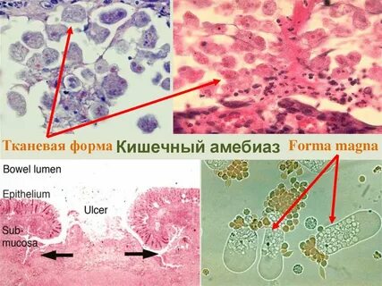 Тканевая форма
