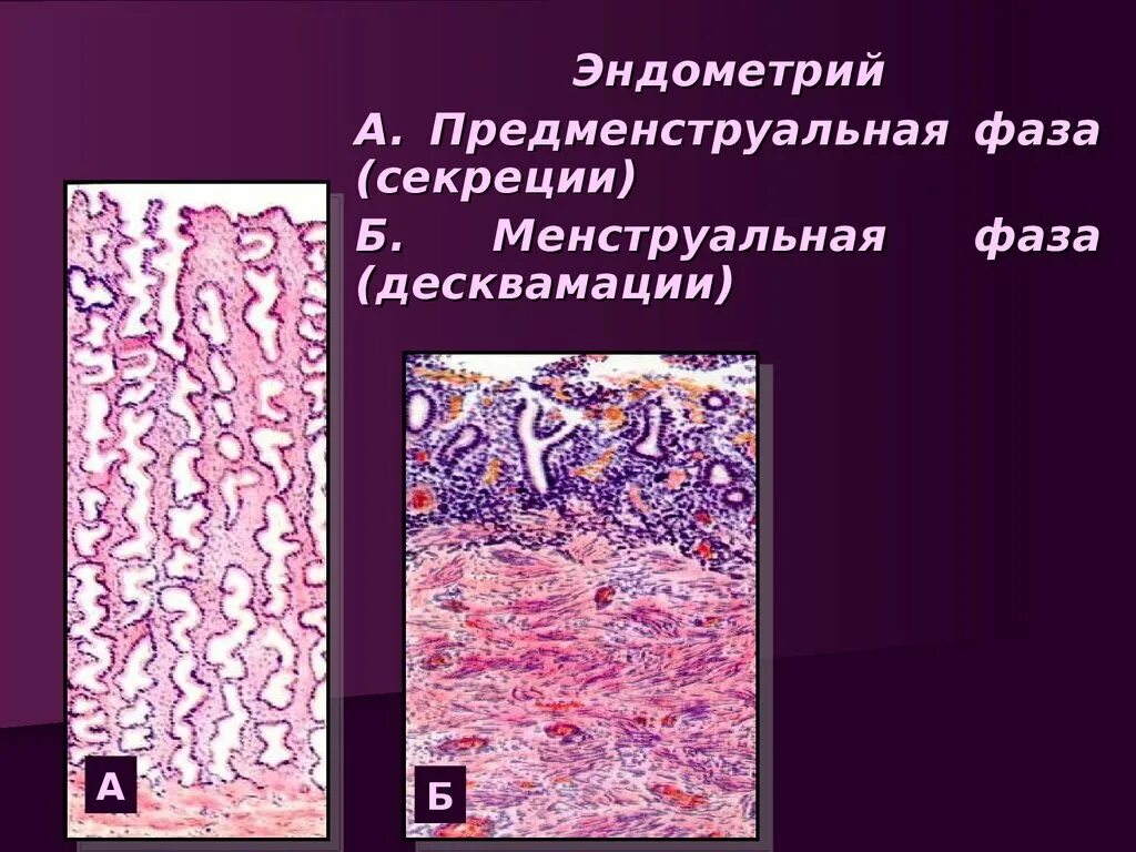 Эндометрий обратного развития. Эндометрий фазы десквамации гистология. Десквамация это гистология. Фаза секреции эндометрия гистология. Стадия секреции эндометрия гистология.