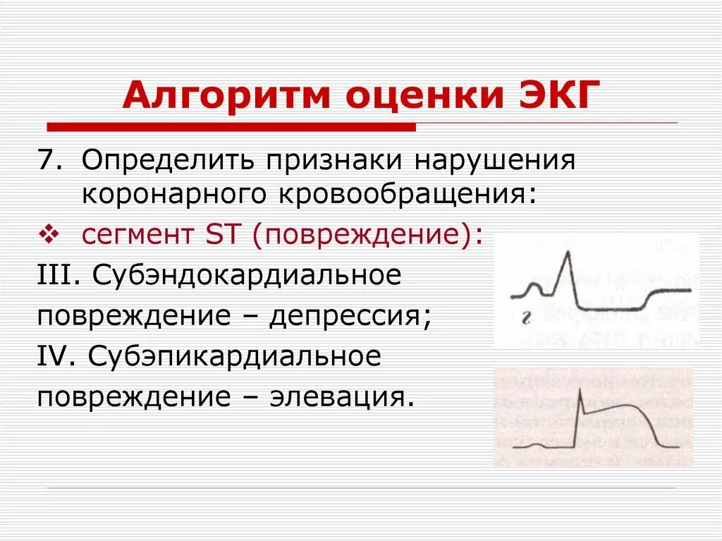 Субэндокардиальное повреждение на ЭКГ. Алгоритм оценки ЭКГ. ЭКГ патологии. ЭКГ нарушения. Тяжелое экг