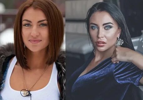 Вики до пластики