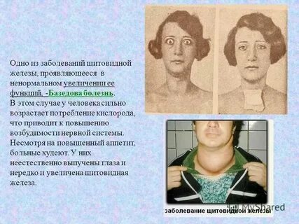 Ответы на тесты тиреоидиты у детей